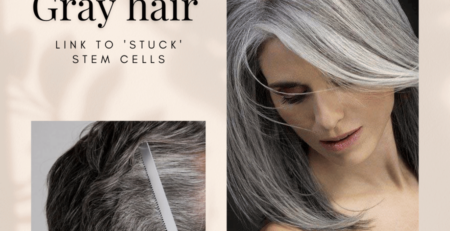 Gray hair with age Link to 'stuck' stem cells